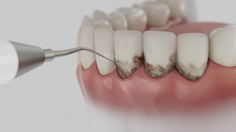 Reliable Teeth Cleaning And Checkup contractor in Benzie County County, MI by Dentist Open Now
